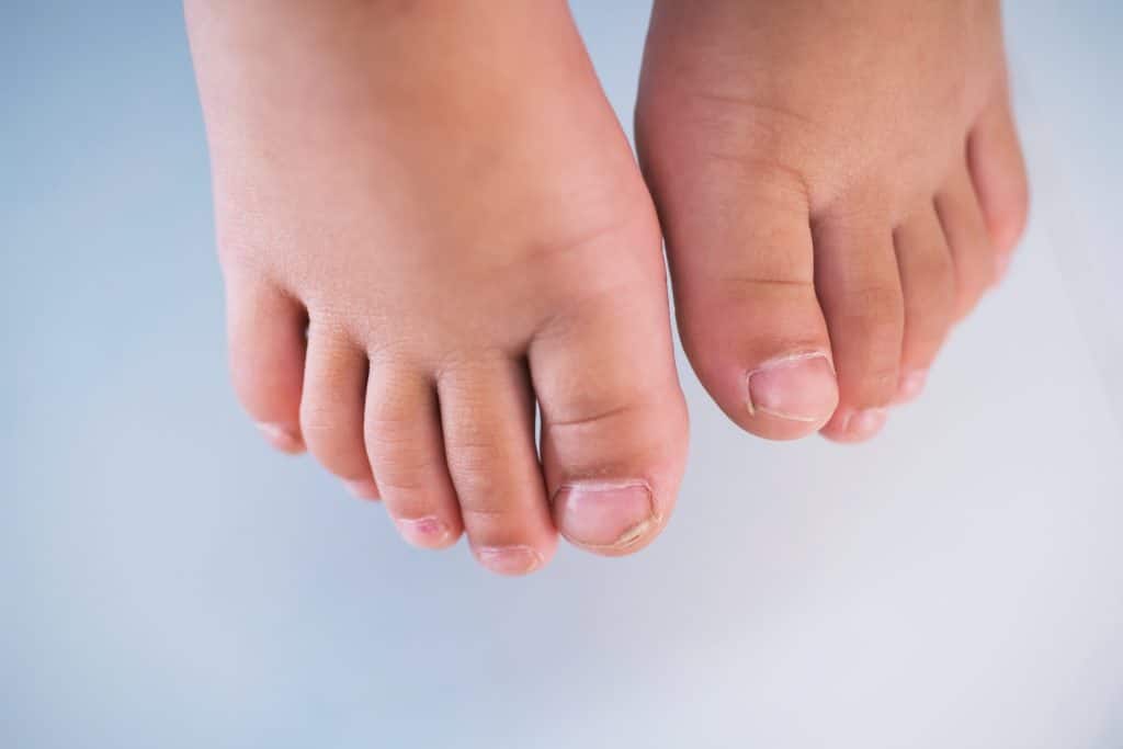 Quelles en sont les causes ?