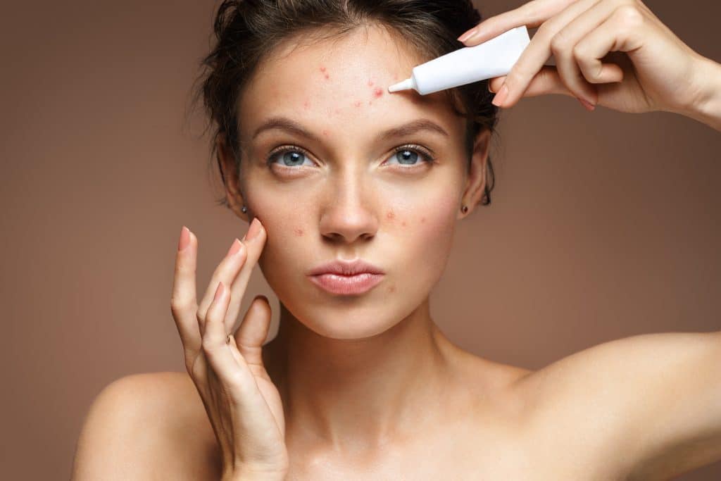Comment se débarrasser de l’acné rapidement ?