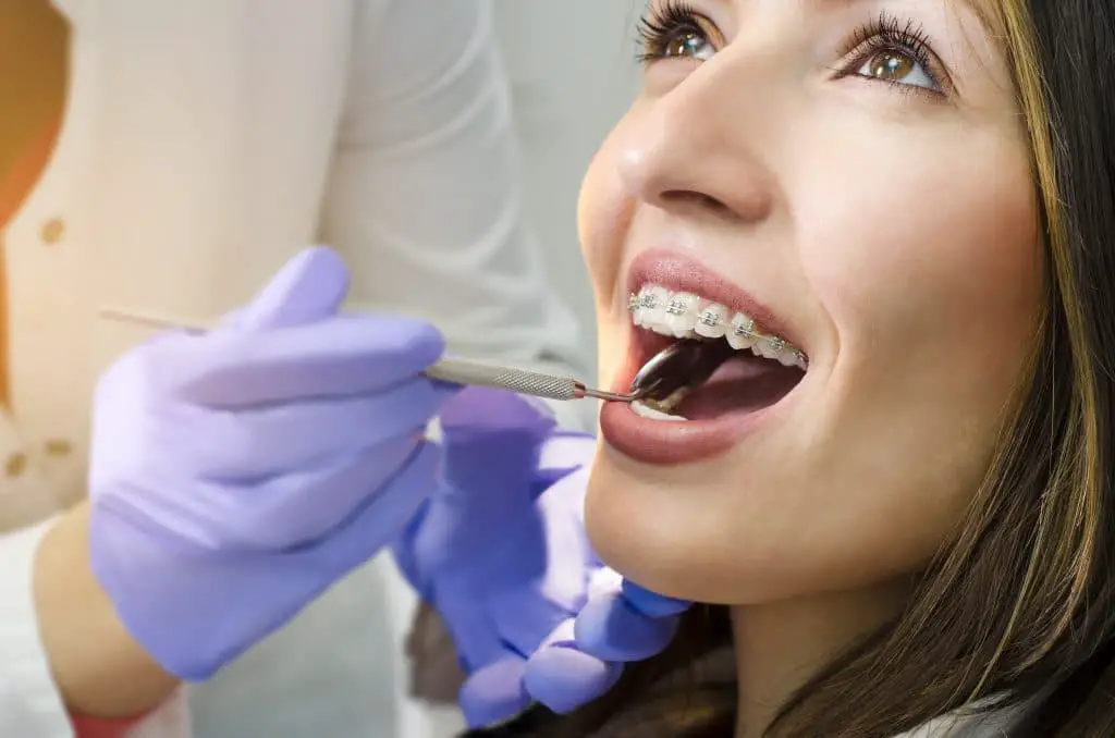 Quel est le prix d'un traitement orthodontique pour les adultes ?