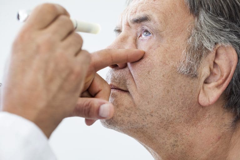 Cataracte secondaire : symptômes, causes et traitement