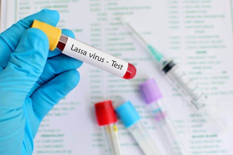 Premier cas de fièvre Lassa en France :  faut-il s’inquiéter ?