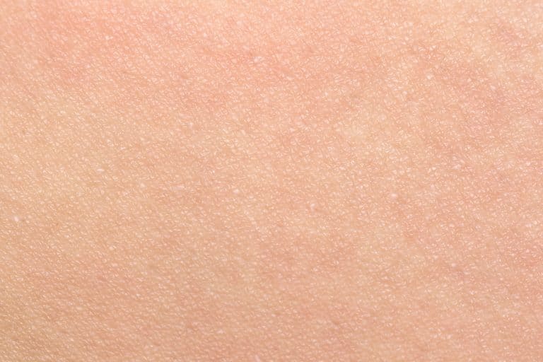 Zoom sur les maladies de la peau des enfants Zoom sur les maladies de la peau des enfants