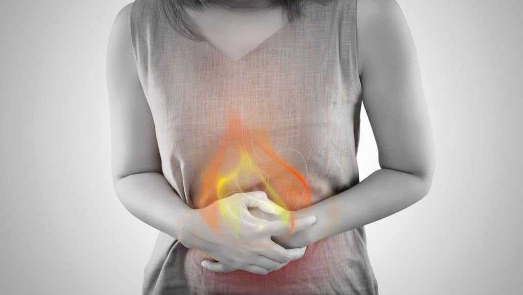 brulure d'estomac