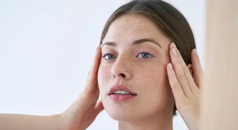 Mélasma : Comment traiter les taches brunes sur le visage